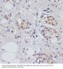 Exosome RNA Helicase MTR4 (MTR4/SKIV2L2) Antibody