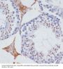 Exosome RNA Helicase MTR4 (MTR4/SKIV2L2) Antibody