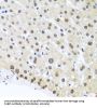 Far Upstream Element (FUSE) Binding Protein 1 (FUBP1) Antibody