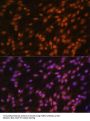 Far Upstream Element (FUSE) Binding Protein 1 (FUBP1) Antibody