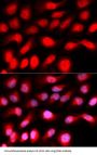 Zinc Finger E-Box-Binding Homeobox 1 (ZEB1) Antibody