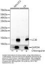 Microtubule-Associated Proteins 1A/1B Light Chain 3B (MAP1LC3B) Antibody