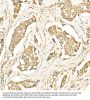 Microtubule-Associated Proteins 1A/1B Light Chain 3B (MAP1LC3B) Antibody