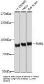Fragile X Mental Retardation 1 (FMR1) Antibody