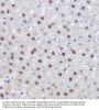 Peroxisome Proliferator Activated Receptor Delta (PPARD) Antibody