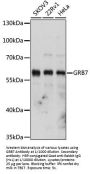Growth Factor Receptor Bound Protein 7 (GRB7) Antibody