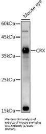 Cone-Rod Homeobox (CRX) Antibody
