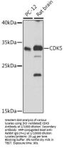 Cyclin-Dependent-Like Kinase 5 (CDK5) Antibody