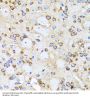 Actin-Related Protein 2 (ACTR2) Antibody
