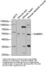 Gamma-Aminobutyric Acid Receptor Subunit Rho-1 (gABRR1) Antibody