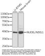 NudE Neurodevelopment Protein 1 Like 1 (NDEL1) Antibody