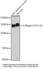 Collagen Type I Alpha 2 (COL1A2) Antibody