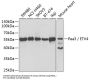 ETS Translocation Variant 4 (ETV4) Antibody