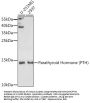 Parathyroid Hormone (PTH) Antibody