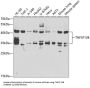 Tumor Necrosis Factor Ligand Superfamily Member 13B / BAFF (TNFSF13B) Antibody