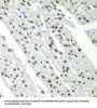 Splicing Factor 3B Subunit 2 (SF3B2) Antibody