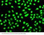 Splicing Factor 3B Subunit 2 (SF3B2) Antibody
