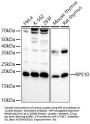 Ribosomal Protein S10 (RPS10) Antibody