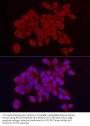 Ribosomal Protein S10 (RPS10) Antibody