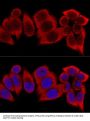 Ribosomal Protein S12 (RPS12) Antibody