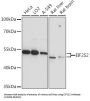 Eukaryotic Translation Initiation Factor 2 Subunit 2 (EIF2S2) Antibody