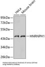 Heterogeneous Nuclear Ribonucleoprotein H (HNRNPH1) Antibody