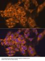 Ribosomal Protein L17 (RPL17) Antibody