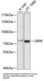 SRP Receptor Alpha Subunit (SRPR) Antibody