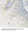 Poly(A) Binding Protein Cytoplasmic 4 (PABPC4) Antibody