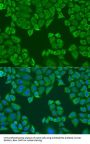 Poly(A) Binding Protein Cytoplasmic 4 (PABPC4) Antibody