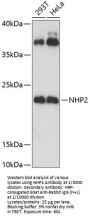 NHP2 Ribonucleoprotein (NHP2) Antibody