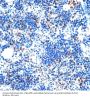 Intron-Binding Protein Aquarius (AQR) Antibody
