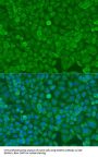 Dicer 1, Ribonuclease Type III (DICER1) Antibody