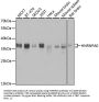 Heterogeneous Nuclear Ribonucleoprotein A0 (HNRNPA0) Antibody