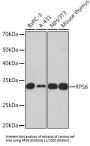 Ribosomal Protein S6 (RPS6) Antibody