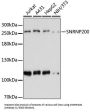 Small Nuclear Ribonucleoprotein U5 Subunit 200 (SNRNP200) Antibody