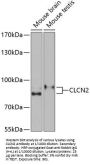 Chloride Channel Protein 2 (CLCN2) Antibody
