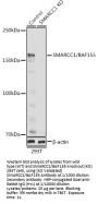 SWI/SNF Related, Matrix Associated, Actin Dependent Regulator of Chromatin Subfamily C Member 1 (SMARCC1) Antibody