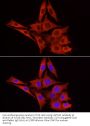 UDP-Glucuronosyltransferase 1-1 (UGT1A1) Antibody