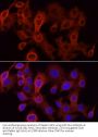 UDP-Glucuronosyltransferase 1-1 (UGT1A1) Antibody