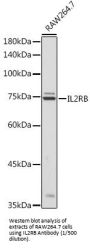 Interleukin 2 Receptor Beta (IL2RB) Antibody
