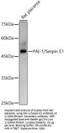 Serpin Family E Member 1 (SERPINE1) Antibody