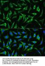 Serpin Family E Member 1 (SERPINE1) Antibody