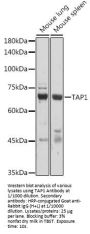 Antigen Peptide Transporter 1 (TAP1) Antibody