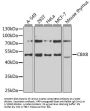 Chromobox Protein Homolog 8 (CBX8) Antibody