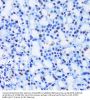 Chromobox Protein Homolog 8 (CBX8) Antibody