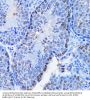 Chromobox Protein Homolog 8 (CBX8) Antibody
