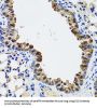 S-Formylglutathione Hydrolase (ESD) Antibody