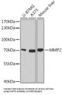 Matrix Metalloproteinase 2 (MMP2) Antibody