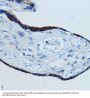 Matrix Metalloproteinase 2 (MMP2) Antibody